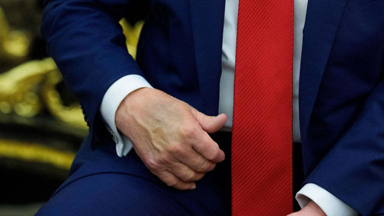 Donald Trump and Mitch McConnell hand bruises renew health questions ...