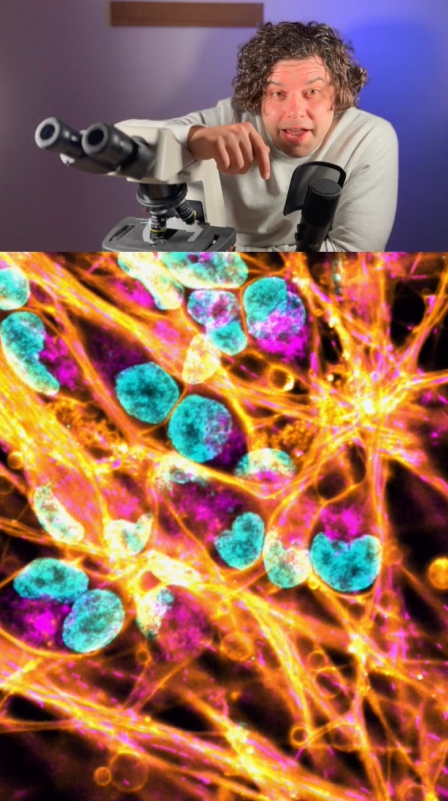 Cancer cells neuronal cells and moss under microscope