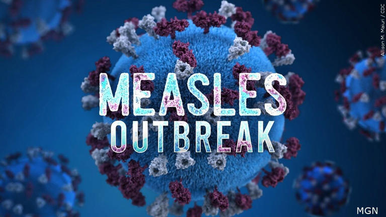 Measles case confirmed in Tuscola County