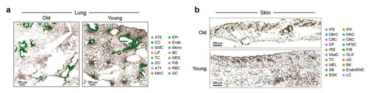 AI-powered barcode unmasks 'zombie cells' in aging tissue