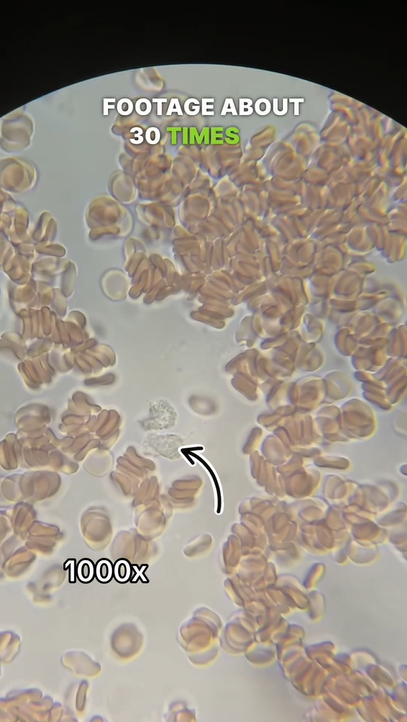 White blood cells in action under a microscope