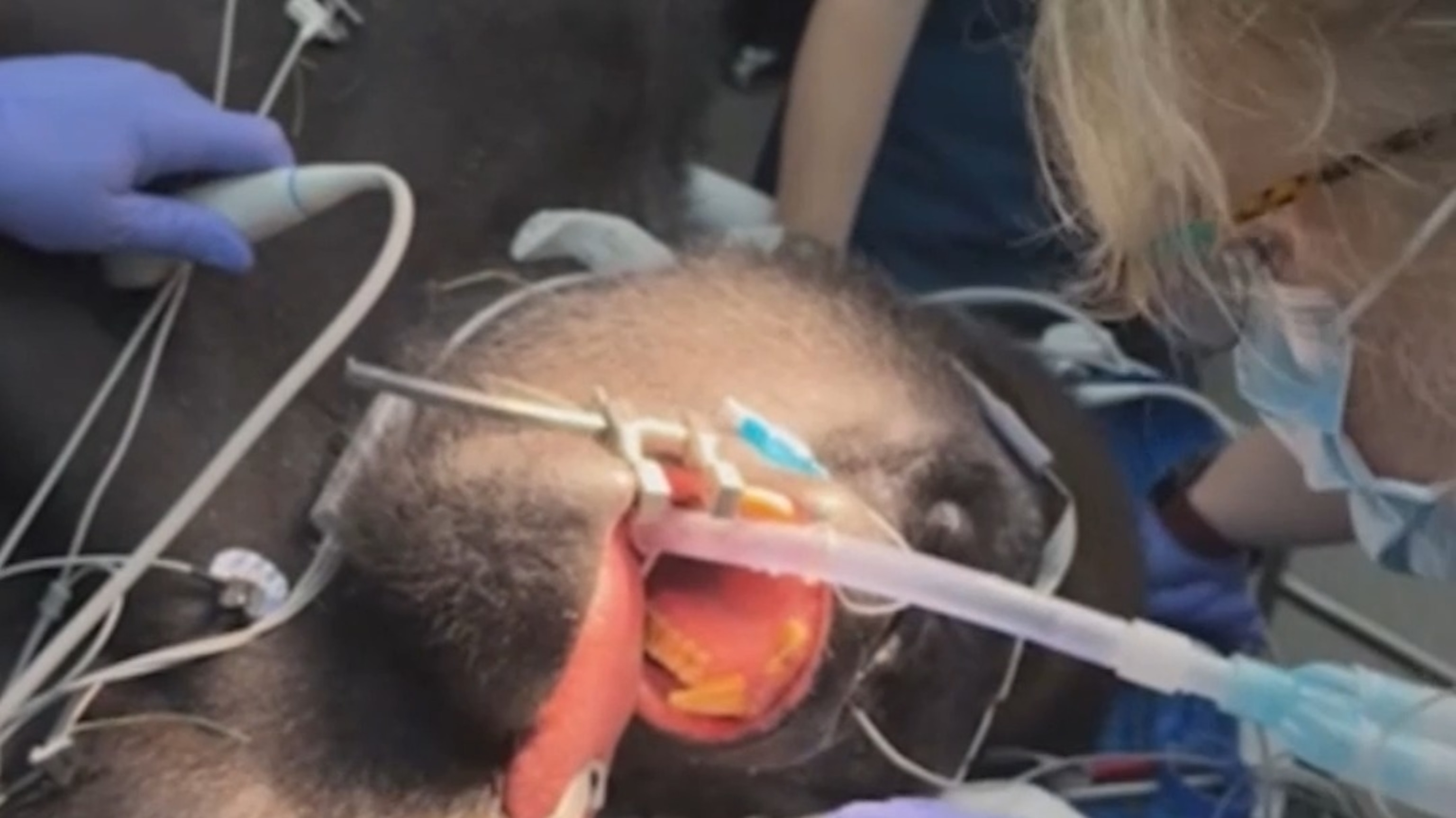 Silverback gorilla gets wellness check at Disney's Animal Kingdom