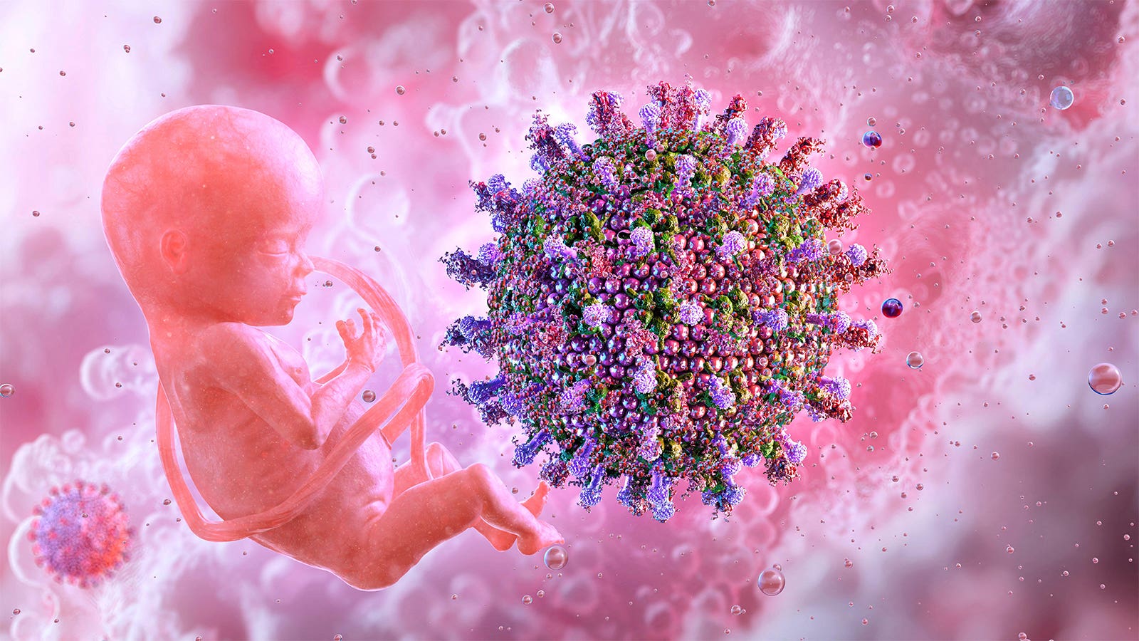Rare congenital TORCH infections tied to greater autism risk in kids