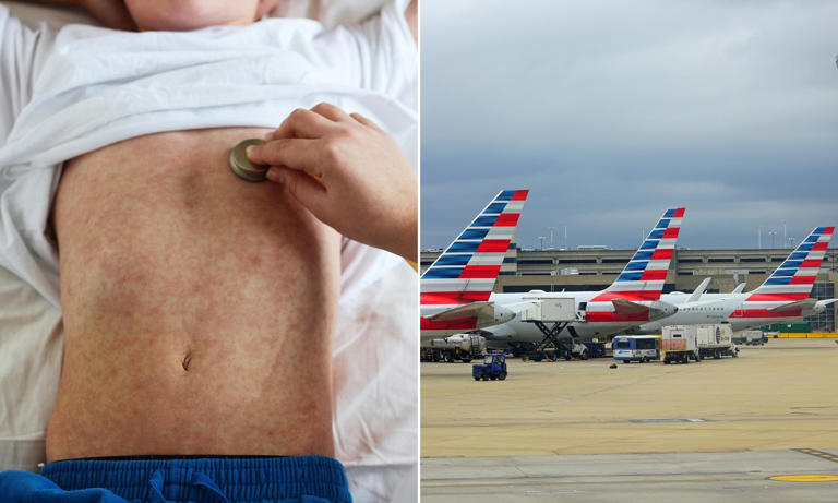 Thousands potentially exposed to measles at multiple transportation ...
