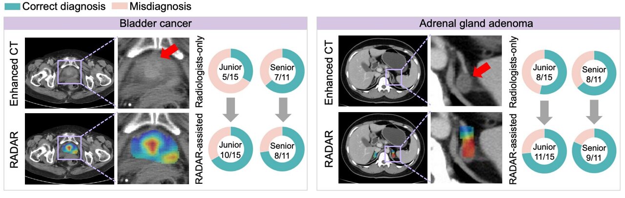 AI assistant learns from radiology reports to spot problems in ...