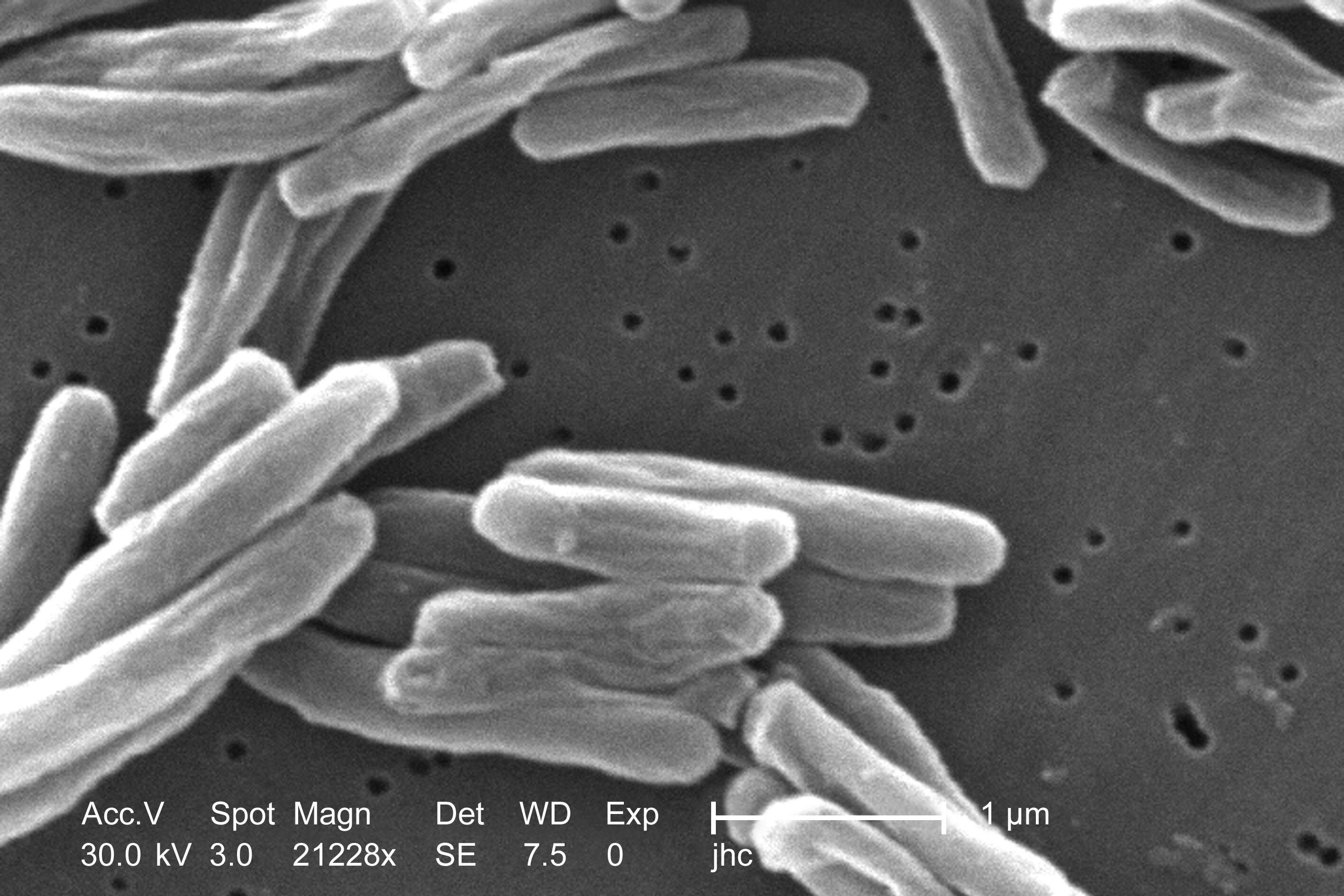 TUSD alerts parents about tuberculosis case at Van Buskirk Elementary ...