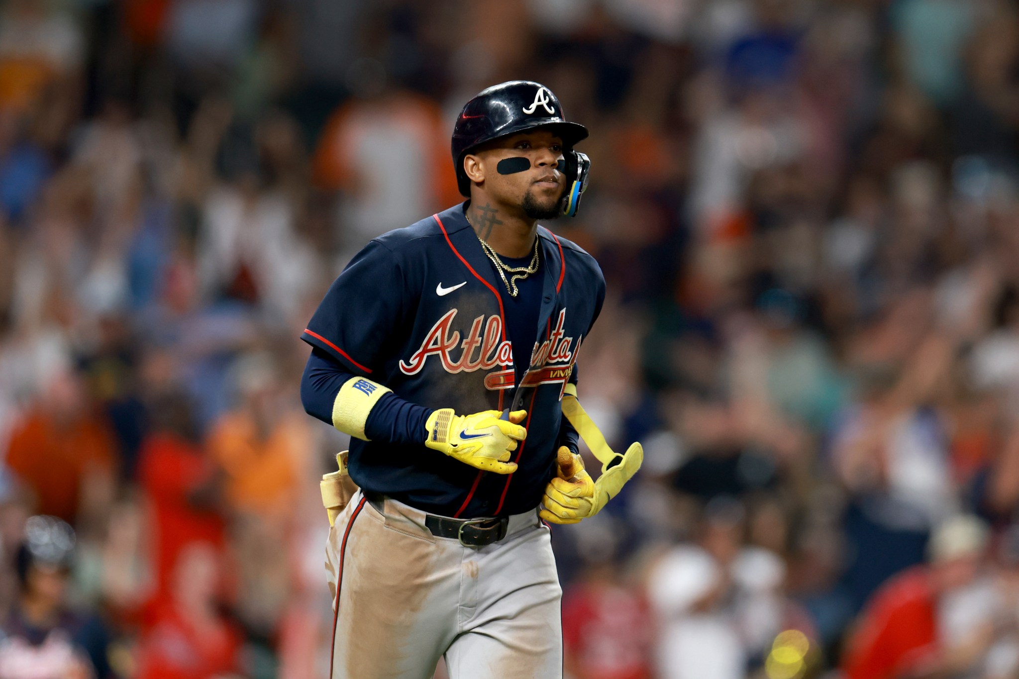 Braves reveal Ronald Acuna Jr. status after injury scare