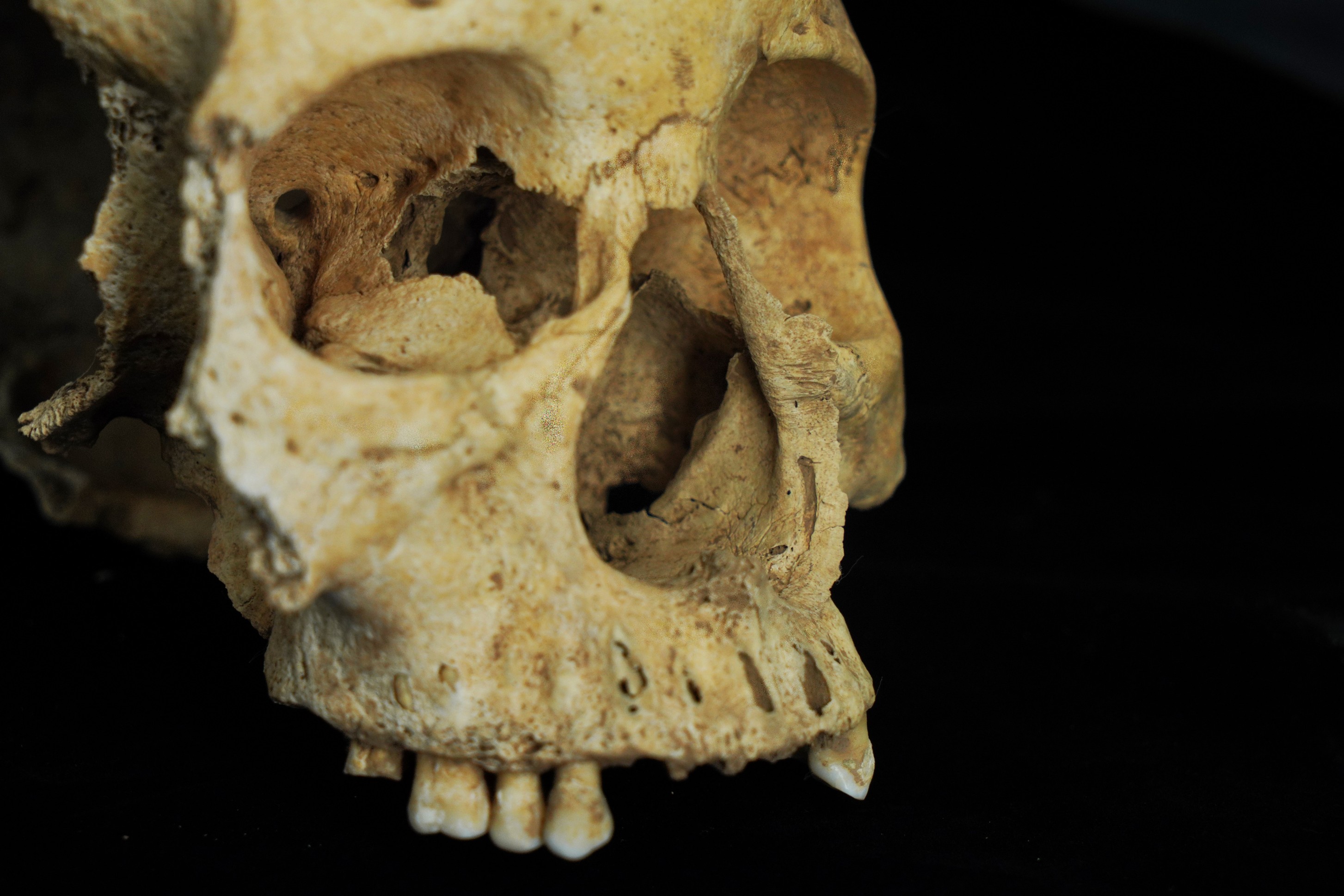 This woman who lived in 14th-century China may have had her nose cut ...