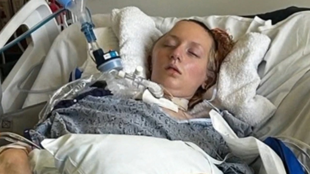 California Six Flags rollercoaster left more than 100 people with brain ...