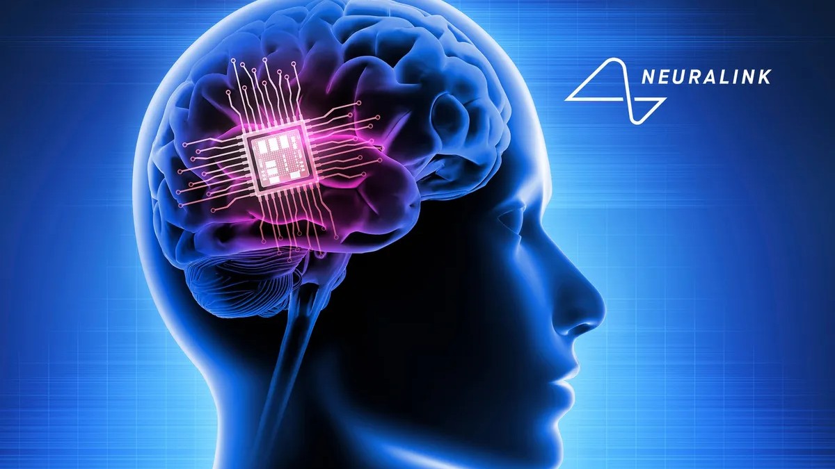 Neuralink’s brain chip is moving into humans - 1,024 electrodes could ...