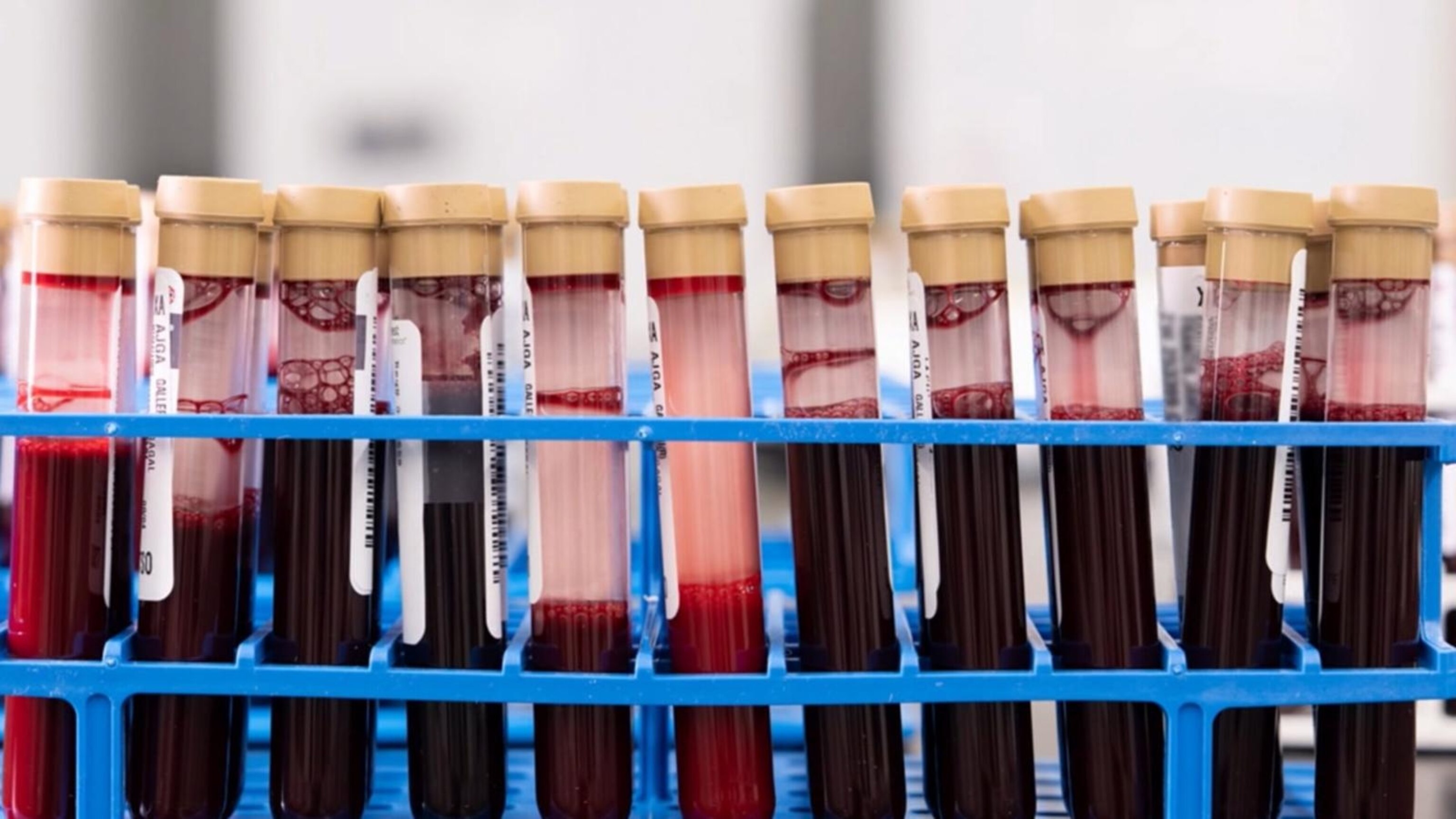 New blood test could potentially look for signs of dozens of cancers
