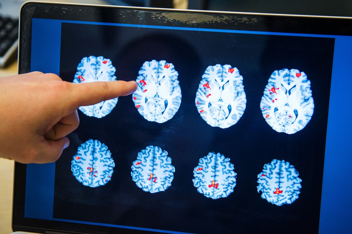 Mental health predicted by child brain development, new study finds