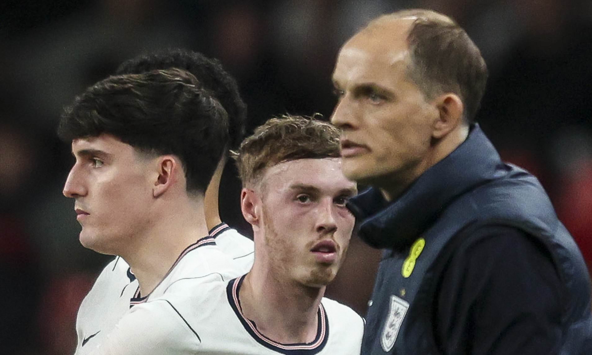 Thomas Tuchel casts doubt on Cole Palmer's desire to play for England ...