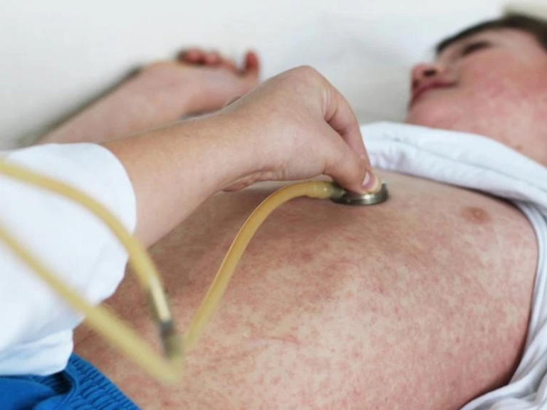 Virus warning as outbreak widens