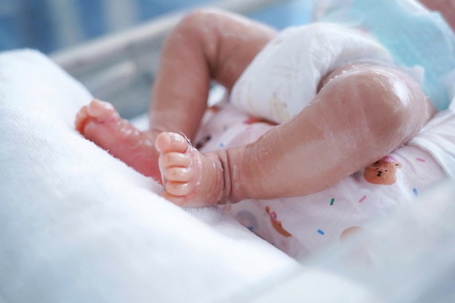Da bé trai sơ sinh khô nứt bất thường, bác sĩ phát hiện mắc bệnh vảy cá hiếm gặp