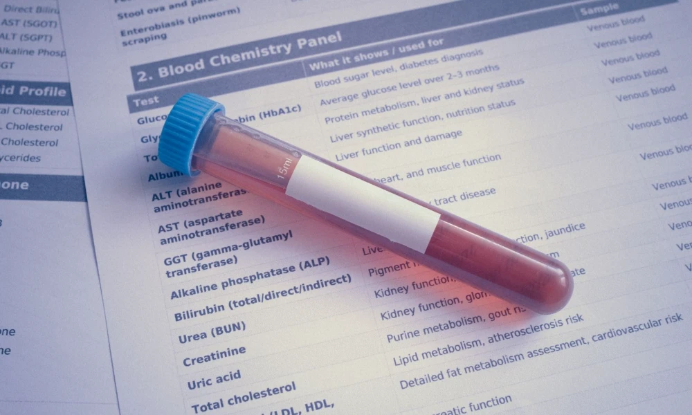 What actually moves an A1C, and where Ceylon cinnamon fits