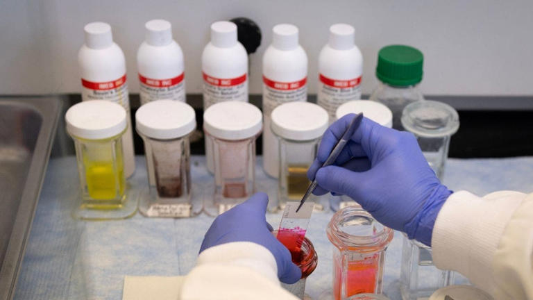 US monitoring suspected fatal pneumonic plague case in Russia, State ...
