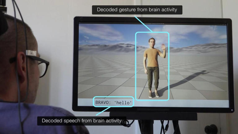 Un implante cerebral logra decodificar habla y gestos simultáneamente en personas con parálisis