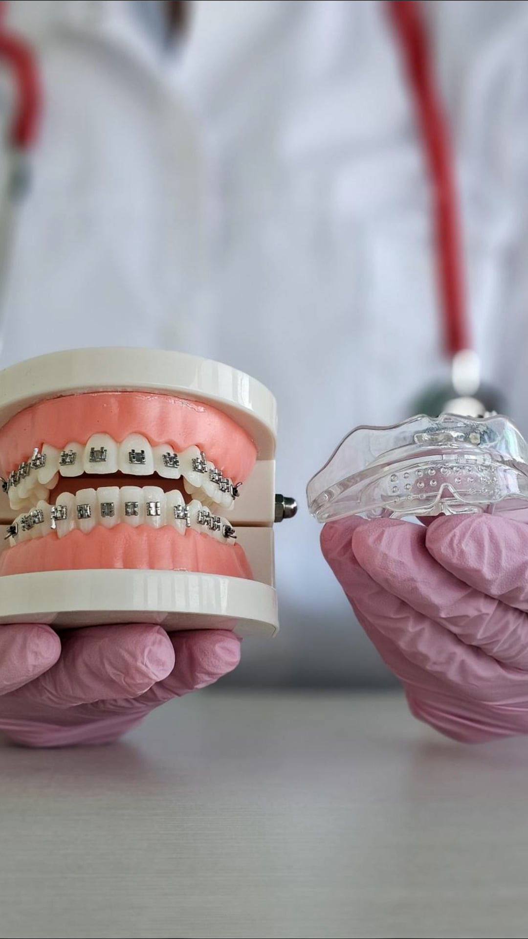 Invisalign ou appareils : quelle option vous convient le mieux?