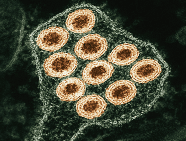 Rabies alert issued for parts of Hillsborough County after unvaccinated ...