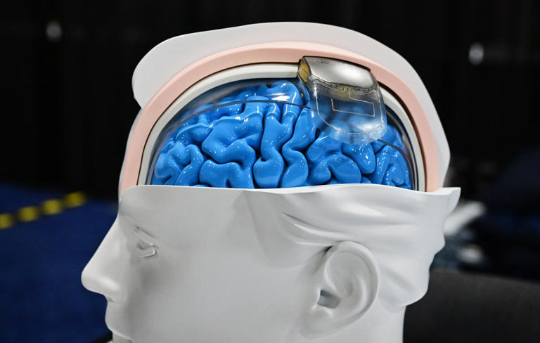 China sets world's first AI brain-data standard; FDA has no equivalent