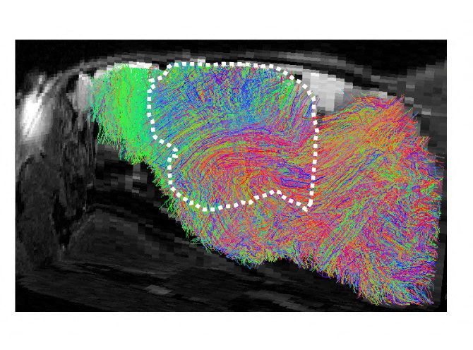 Scientists transplant lab-grown human brain tissue into mice