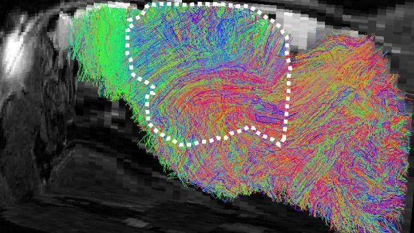 Part-human part-mouse brain developed in science breakthrough