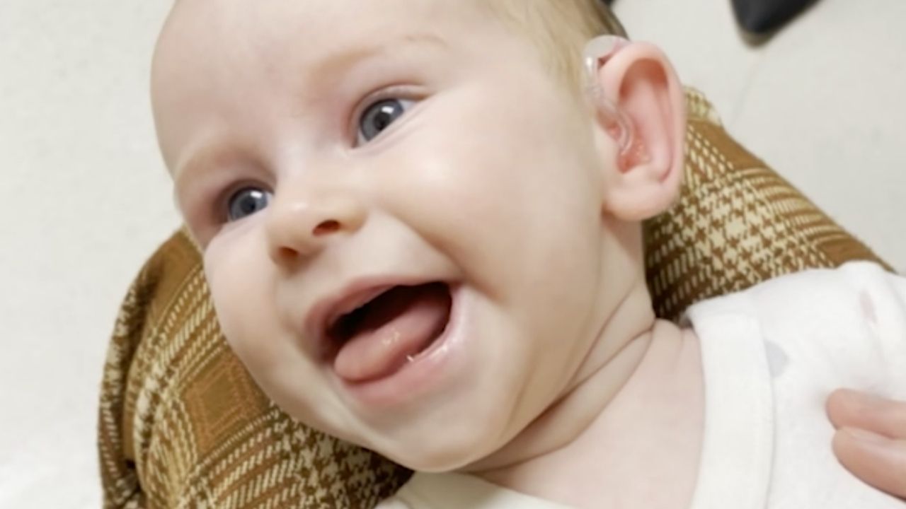 Crying baby giggles when she hears parents' voices clearly for first ...