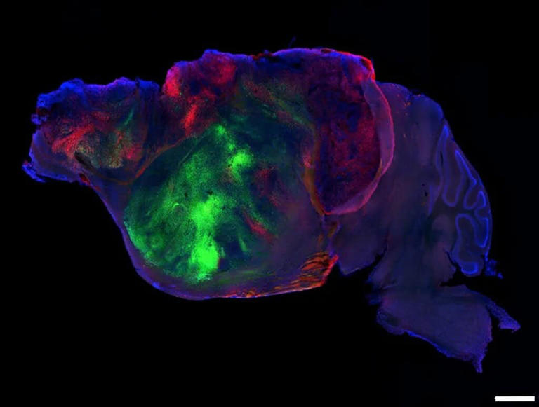 Scientists grew human brain tissue inside mice and it actually worked
