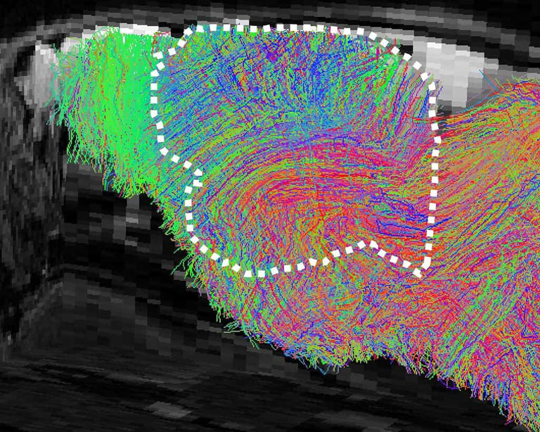 Scientists grew human brain tissue inside mice and it actually worked