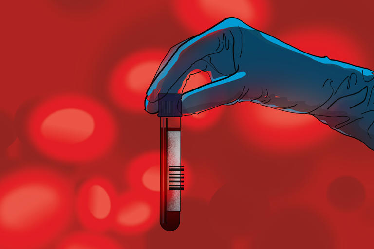 Why the US urgently needs more platelet donors