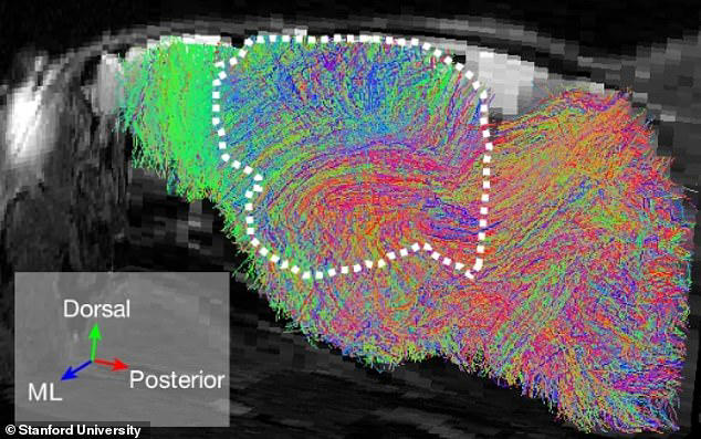 Rise of the Frankenmice! Scientists create mice with half-human brains