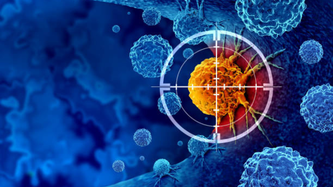 Panxeon: New blood test may detect pancreatic cancer before it begins ...