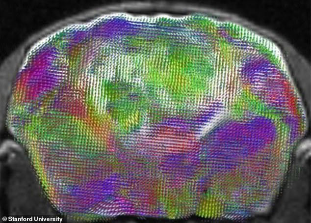 Rise of the Frankenmice! Scientists create mice with half-human brains
