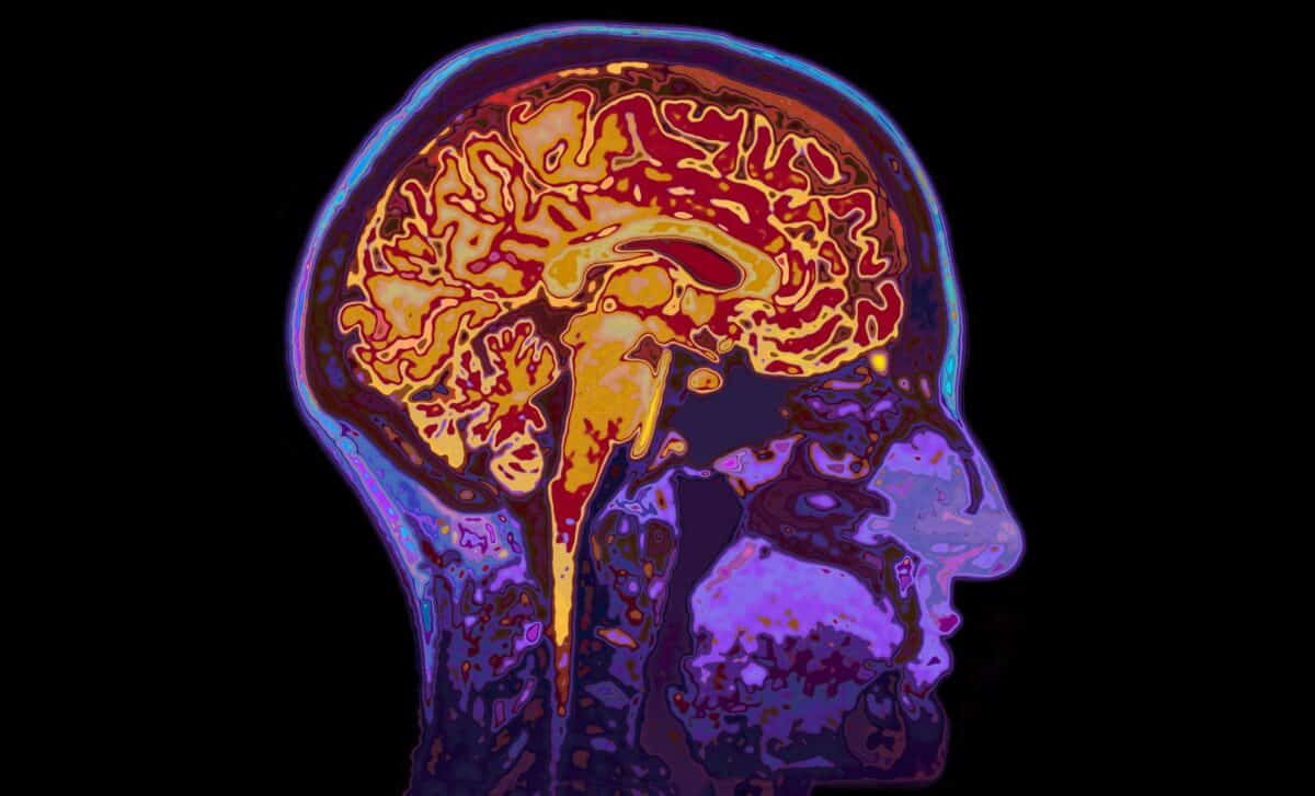 Your brain may clean itself better at night, and MIT found a way to ...