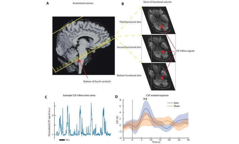 Your brain may clean itself better at night, and MIT found a way to ...