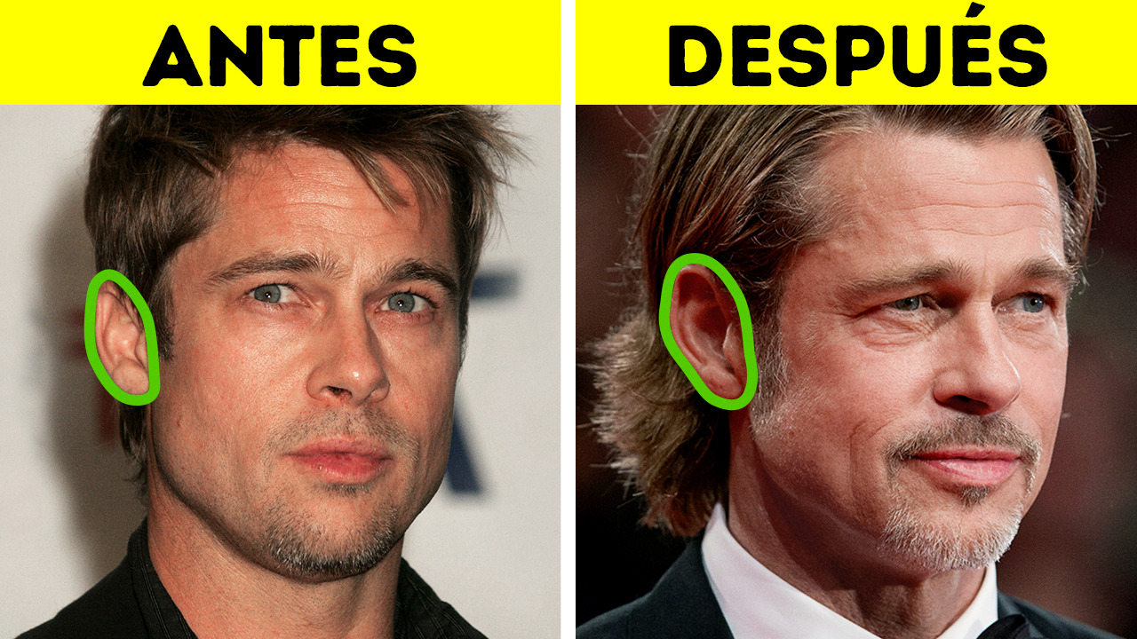 ¿Realmente las orejas nunca dejan de crecer?