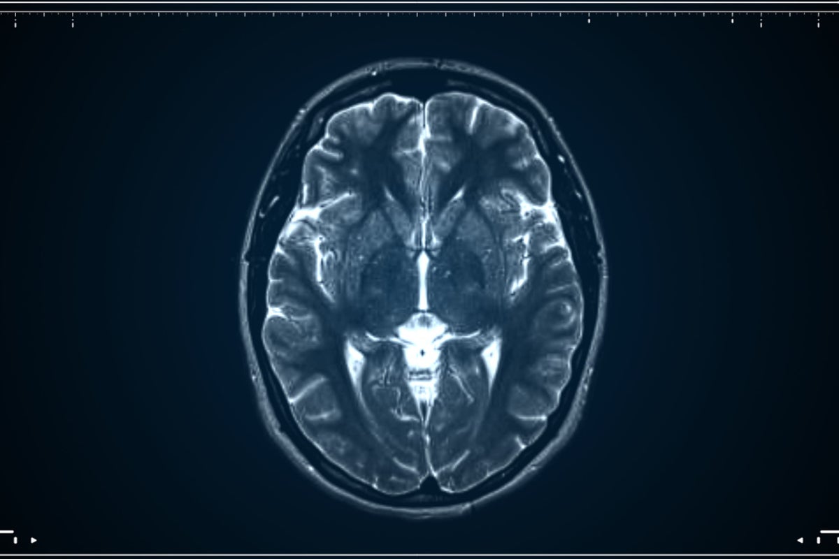 Human brain is actually two separate organs, scientists find
