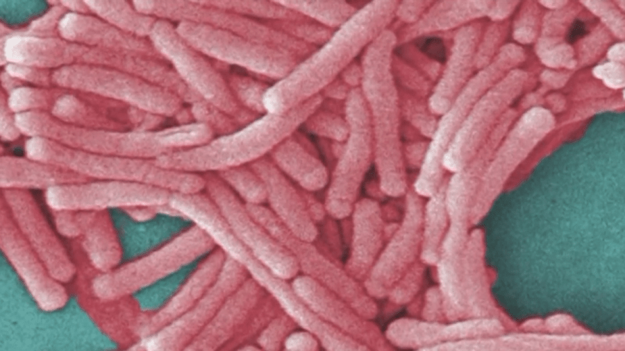 Second death confirmed in Bronx Legionnaires’ disease cluster