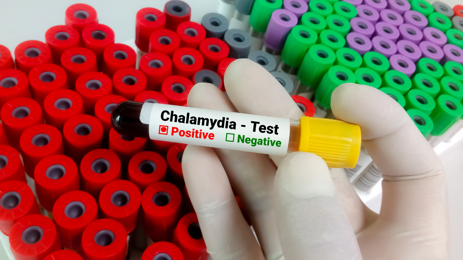 How is chlamydia tested and treated during pregnancy