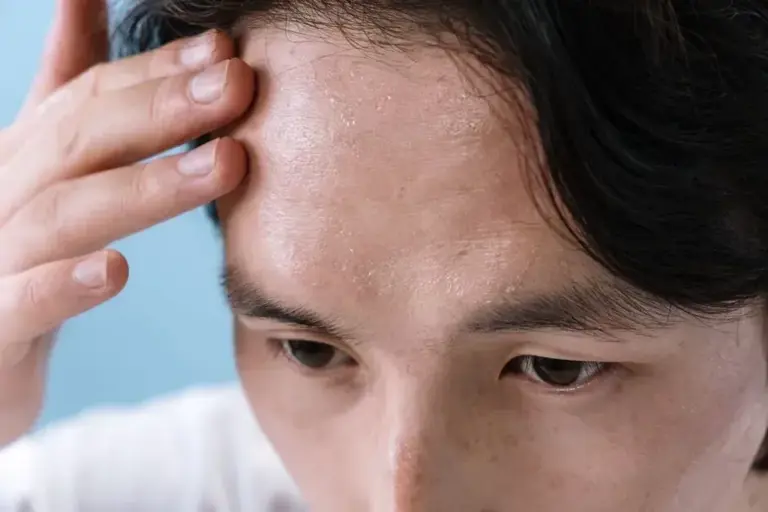 4 reasons humidity makes hot days feel hotter