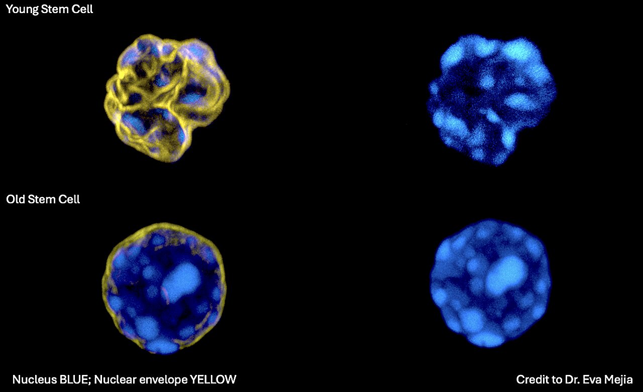 AI detects signs of aging in blood stem cells from nuclear images