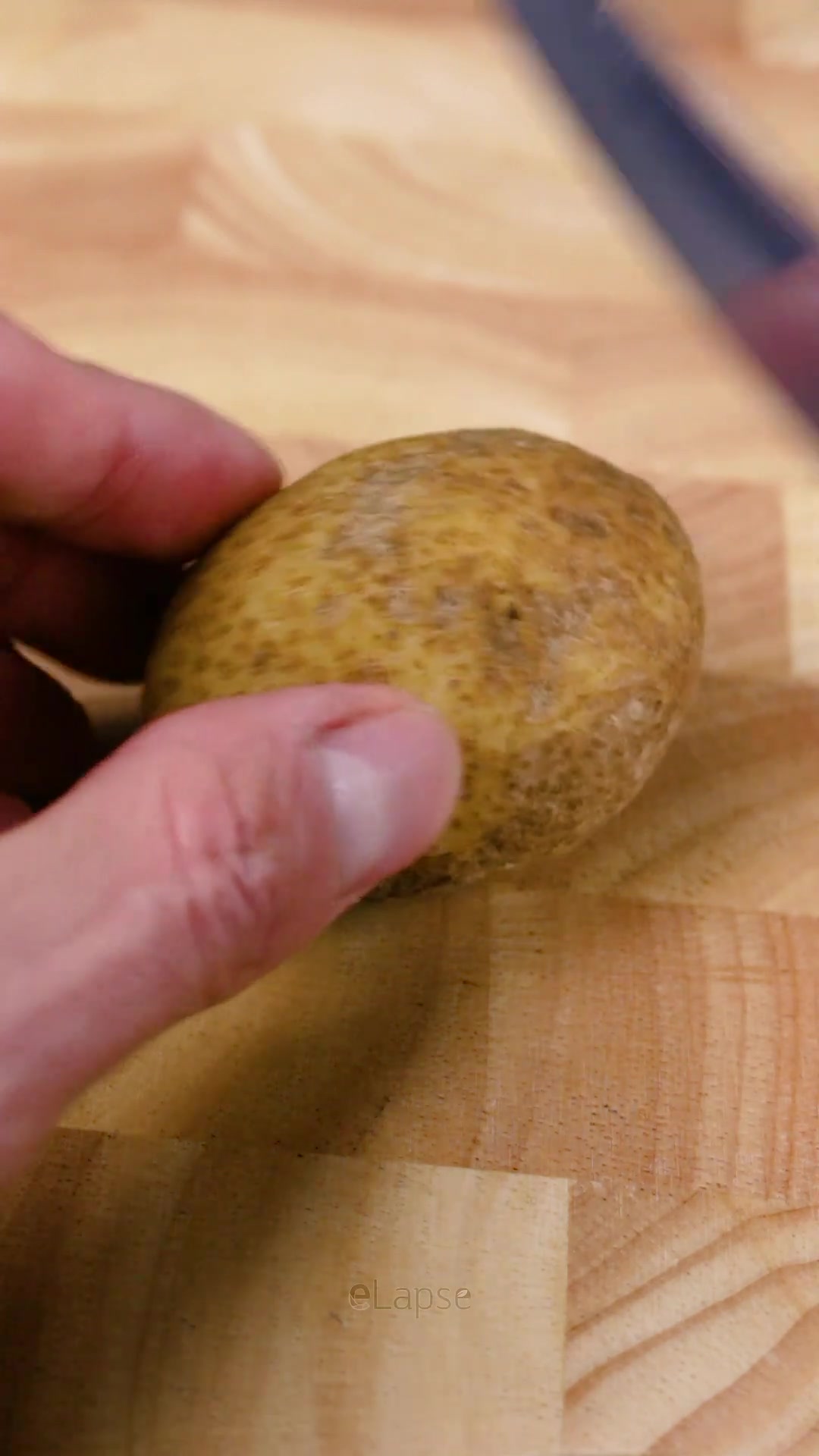 Potato under microscope