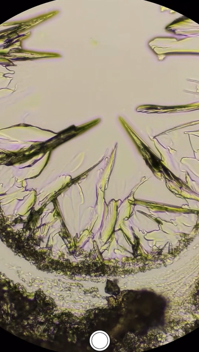 Ibuprofen crystals revealed through a fascinating microscope view