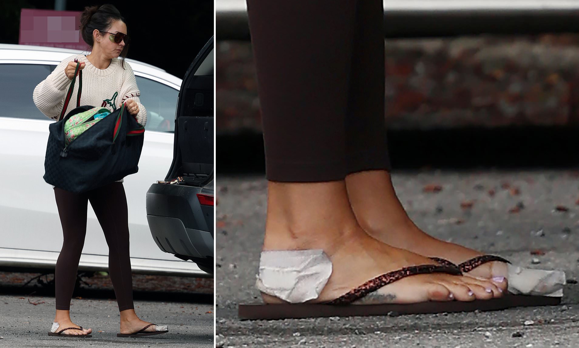 Lacey Turner displays her Strictly injuries as she arrives at ...