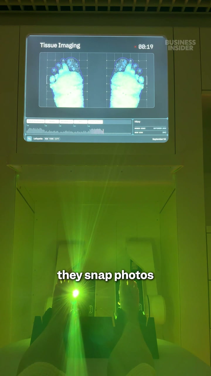 Trying a $500 full-body longevity scan