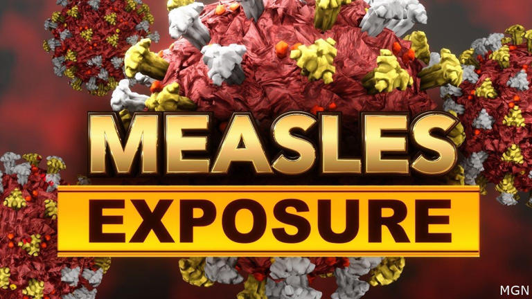 Measles contact tracing continues in Lewis County