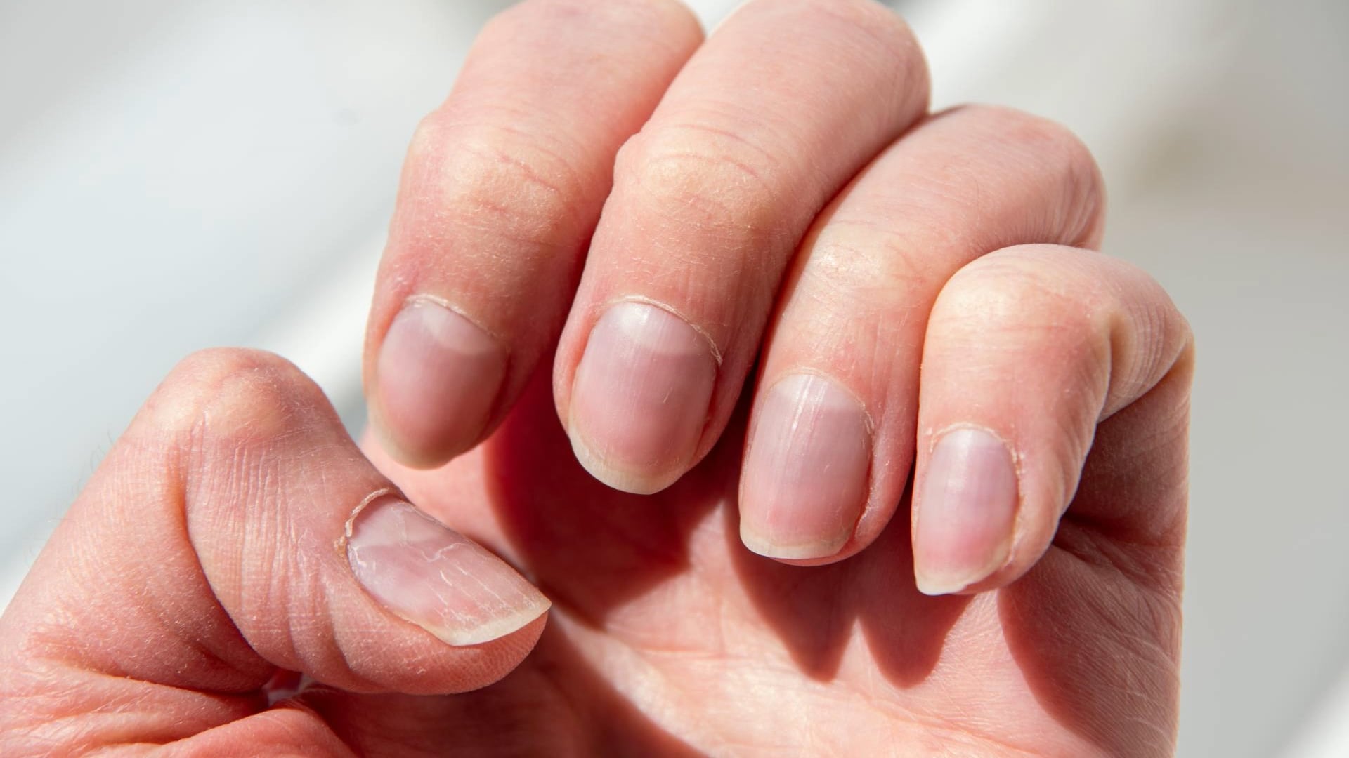 Why you have vertical nail ridges (and how to smooth them)