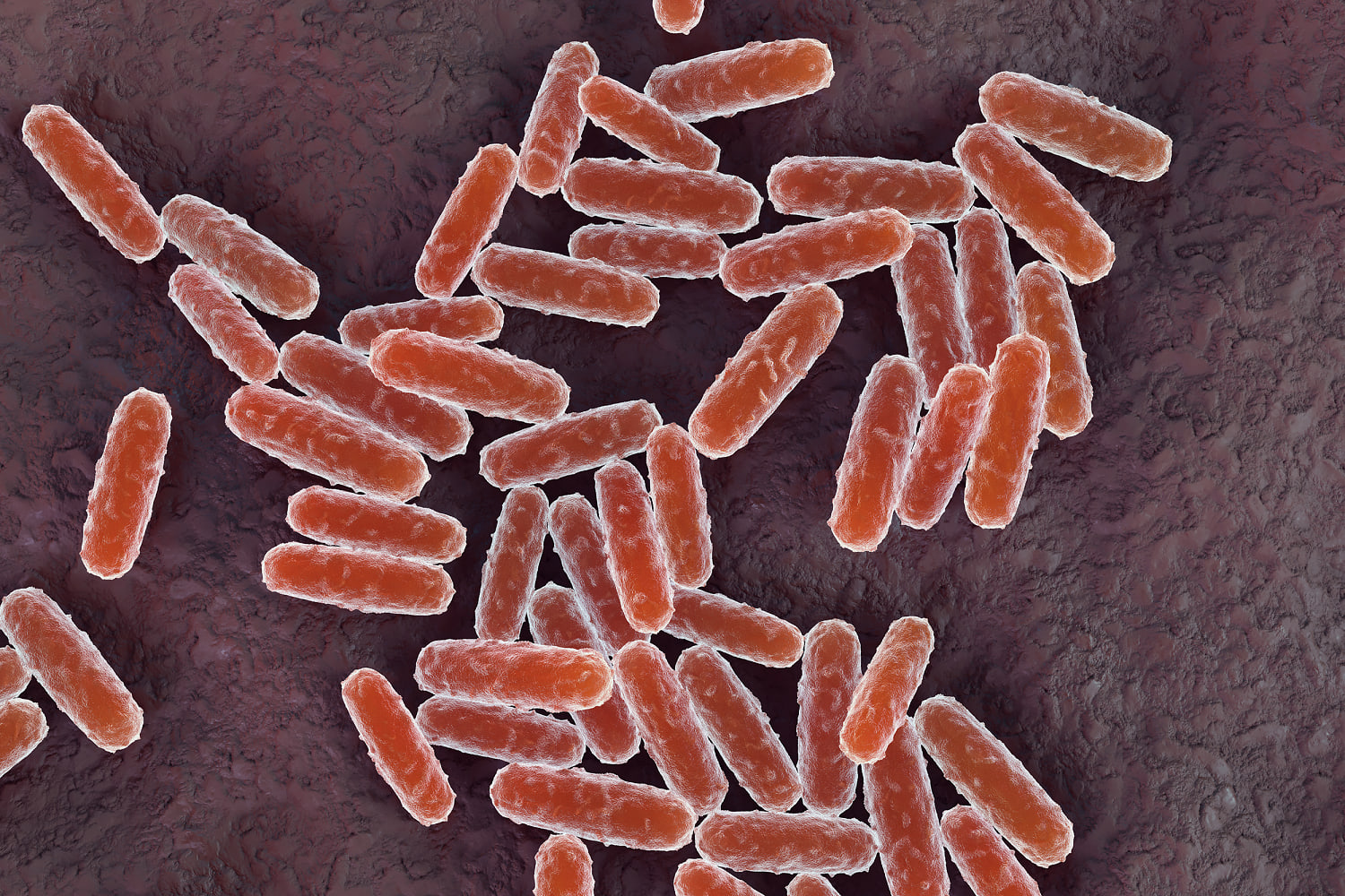 Russian lab worker dies of suspected plague as 200 enter medical ...