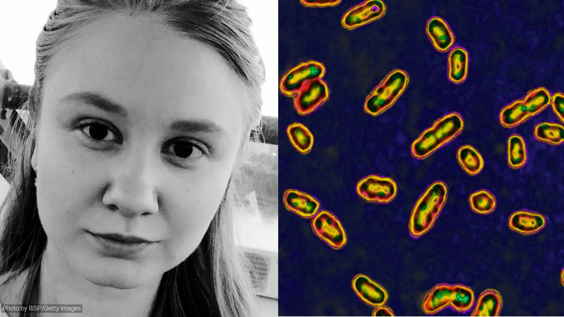 Russian lab worker dies of suspected plague, hundreds quarantined